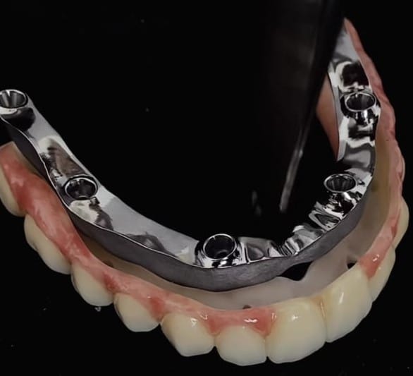 Precision dental laboratory tools