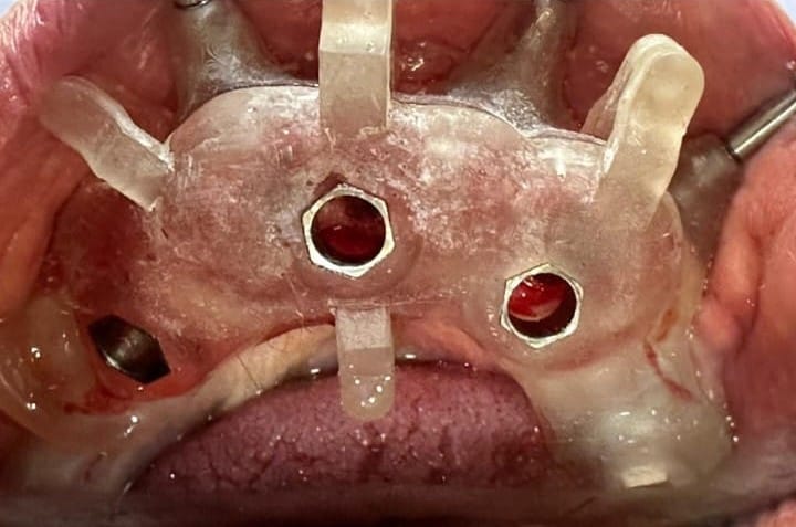 Dentist consultation at Dentovate clinic